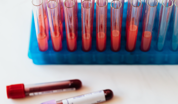 A number of blood sample collection tubes, most with the top off in a holding tray.